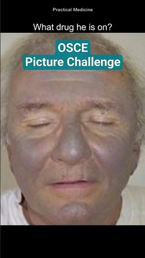 Which Drug has caused this?