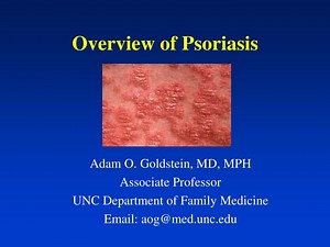 Overview of Psoriasis - SlideServe