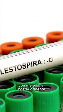 Leptospirosis and its serious consequences | Medical Report with Dr. Julio Castro #medicine
