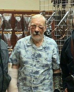 Man Survives Bear Attack but Loses Face