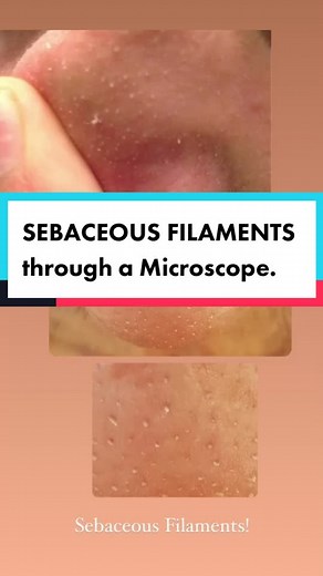 Dr. Mike D | Acne Doctor on TikTok