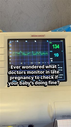 𝗗𝗿 𝗦𝗮𝗿𝗴𝗮𝗺 𝗦𝗼𝗻𝗶- 𝐃𝐨𝐜𝐭𝐨𝐫 𝐏𝐨𝐬𝐢𝐭𝐢𝐯𝐞. on Instagram: "The Non-Stress Test, or NST, is a simple, safe, and non-invasive test performed during pregnancy — usually in the third trimester — to check your baby’s well-being. It measures your baby’s heart rate and how it changes with movement. A healthy baby’s heartbeat typically increases when they move — just like how our pulse quickens when we exercise. During the test: • Two small belts are placed on the mother’s abdomen — one m