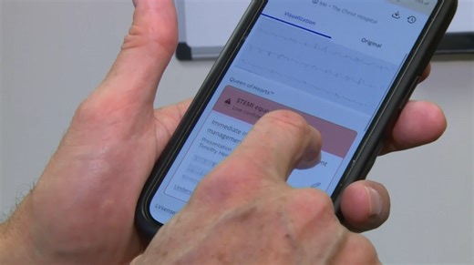 Artificial intelligence developed at Christ Hospital helps doctors detect heart attacks