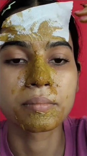 Remove Blackheads Whiteheads in 15 minutes 😱#trend #shortsfeed #hack #shorts #viralvideo #hacks #yt