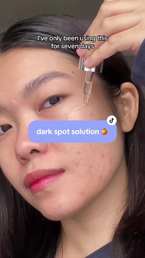 Kiehl’s Clearly Corrective Dark Spot Solution Review