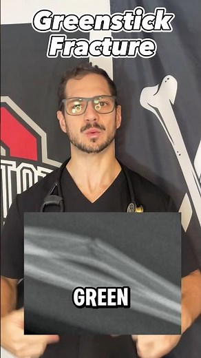 What Is A Greenstick Fracture? #shorts #fracture #medical