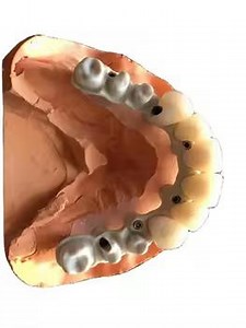 [Hot Item] Kingch 12~25mm Dental Lab Material CAD Cam Block Peek Blank