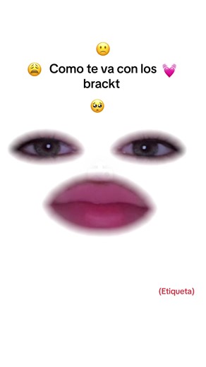 Experiencias con Brackets: ¿Cómo Te Va?