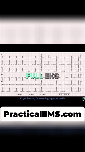 EKG shows prolonged QT interval in a 22F with vomiting. Eyeball test confirms: T-wave exceeds half R-R interval. What's next? #EKG #QTInterval #Medicine #EMS #Diagnosis