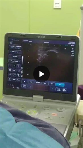 erector spinae block | Ahsan Amjad