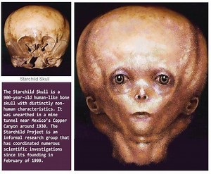 Starchild skull - Alchetron, The Free Social Encyclopedia