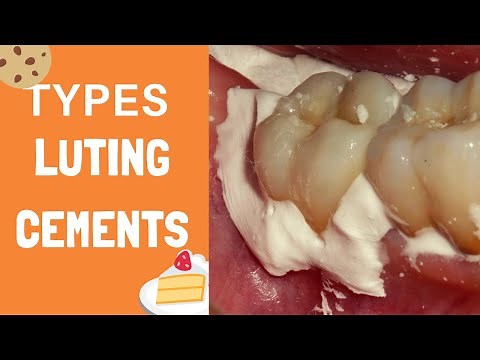 Types of Dental Luting Cement For Crown, Bridge, Veneer, Implant- Cementation in #dentistry