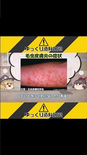 【ゆっくり解説】チャドクガと毒針毛についてチャドクガのよくあらわれる時期と毛虫皮膚炎の症状 #shorts