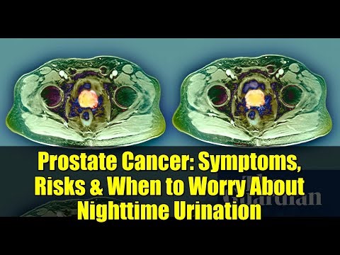 Prostate Cancer: Symptoms, Risks & When to Worry About Nighttime Urination