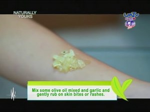 Natural remedies for insect bites