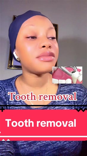 Understanding Tooth Removal and Replacement Options