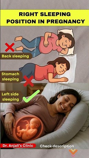 Pregnancy Sleep Guide ✅ The Correct Sleeping Position for Moms to Be | Best Sleeping Position