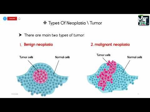 What is neoplasia? ||And it's types and difference between malignant and benign tumor 