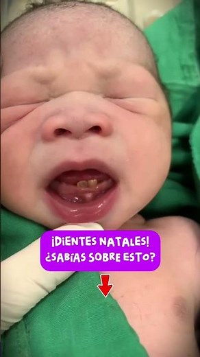 ¿Dientes en bebés? 👶🏻🤔