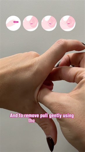 INTIMINA on Instagram: "Switching to Ziggy Cup 2 is a game-changer 🩷 Comfortable & easy to use! #intimina"