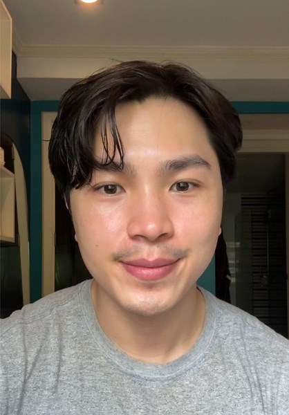 Bio Oil Review: Does It Improve Skin Appearance?