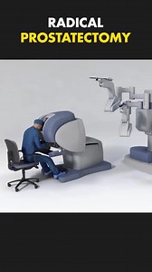353K views · 1.6K reactions | Prostate Glamd Removal Surgery (3D Animation) | Info Insider | Facebook