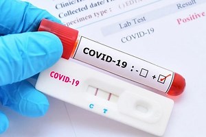 Hướng dẫn 5 bước lấy mẫu test nhanh COVID-19 tại nhà đúng nhất