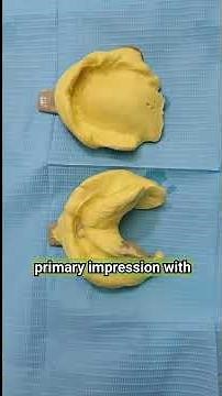 BPS denture biofunctional prosthesis system vs conventional denture what should u know #denture