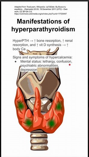 Manifestations of hyperparathyroidism