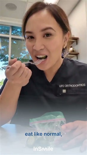 InSmile Braces in Action