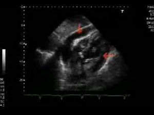 FAST ABCDE /C2: Cardiac Tamponade, Ultrasound Life Support (Winfocus)