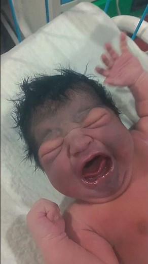 Newborn Baby Severe Cry ⚠️ | Warning Sign of Neonatal Seizure? | Emergency NICU Care