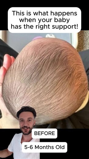 This is what happens when your baby uses the Perfect Noggin! 😍 To learn more, please visit: www.theperfectnoggin.com.au #perfectnoggin #plagiocephaly #brachycephaly #flatheadsyndrome #infantcare