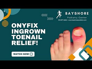 A Painless, Surgery-Free Fix for Ingrown Toenails!