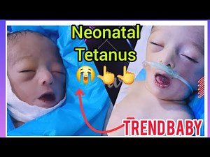 Severe Neonatal Tetanus | Baby in Critical Condition in NICU😭✅️#dailyEducation#foryou#viralbaby✔️📢💥.
