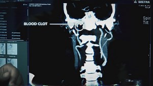 Stroke in the MRI: How a University Hospitals executive made a lifesaving decision we can all learn from