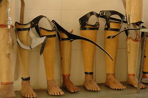 Jaipur Foot: A Cost Effective Prosthetic Leg