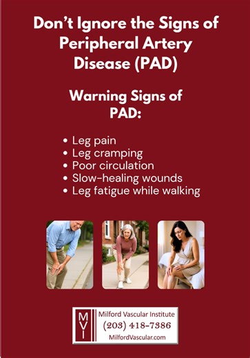 🚨 Don’t Ignore the Signs of Peripheral Artery Disease (PAD) Blocked arteries in your legs can cause more than discomfort — they put you at risk of amputation, heart attack, and stroke. Warning Signs of PAD: - Leg pain, cramping, or fatigue while walking - Poor circulation, cold feet, or slow-healing wounds - Numbness or weakness in the legs PAD is dangerous, progressive, and often silent until it becomes life-threatening. 💡 The Good News At Milford Vascular Institute, our vascular specialists 