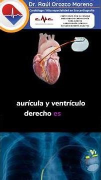🚨Single-chamber or dual-chamber pacemakers 🫀#CardioRaúl