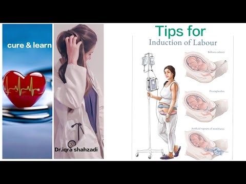 #what#are#the#tips#for#induction#of#labour#pain?