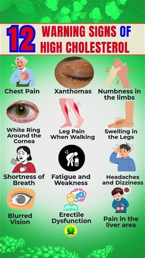 12 Warning SIGNS of HIGH CHOLESTEROL You Shouldn’t Ignore #cholesterol #shortsfeed