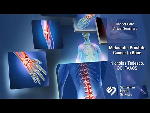 Metastatic Prostate Cancer to Bone – A Cancer Care Seminar