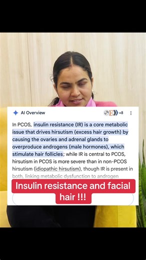 Insulin Resistance and Hirsutism in PCOS Explained