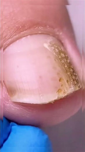 Professional Deep Nail Cleaning Machine Treatment