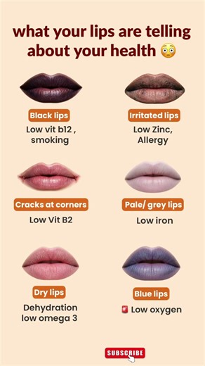 What Your Lips Are Telling You About Your Health | improve health |