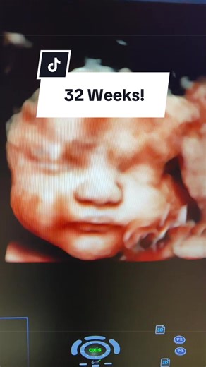 32 weeks 🤍 Your baby is sleeping, growing, and getting ready to meet you 🥹 Meanwhile your body is carrying more blood, more weight, more everything… and you’re feeling it. Those swollen ankles, Braxton Hicks, and tired moments? Completely normal 🤍 You’re doing amazing, mama 🫶 #pregnancy #3rdtrimester #pregnancy #3Dultrasound #32weekspregnant