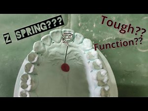 Fabrication of Z SPRING | Double Cantilever Spring || DENTORAL GURU