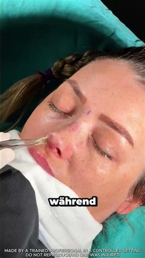 That's not actually a bone...