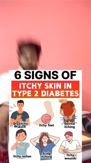 Diabetes Type 2 • Type 1.5 • Type 1 Reversal | Dr Aakarshakk | 6 Signs of Itchy Skin in Type 2 Diabetes 🩺 | Don’t Ignore These Warning Signs! Your skin is trying to tell you something… are you... | Instagram