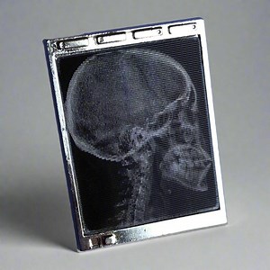 Lenticular Radiology Light Box Enamel Pin- Medical Gift - Gift for Doctor - Gift for Nurse - Enamel Pin for Medical Professionals - Anatomy - Etsy